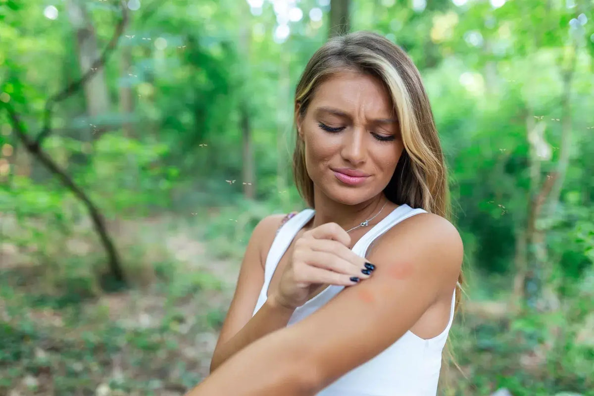 Essential Oils for Bug Bites: Best Oils, Dilution & Roll-On Recipe