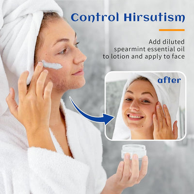 HIQILI Spearmint Essential Oil for PCOS Facial Hair Reduction